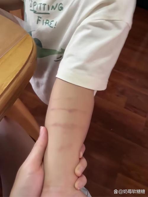 宝宝打人的就医红线,一定要记清