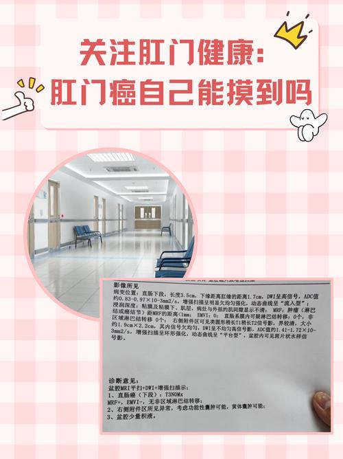 自己摸两下就能提前发现