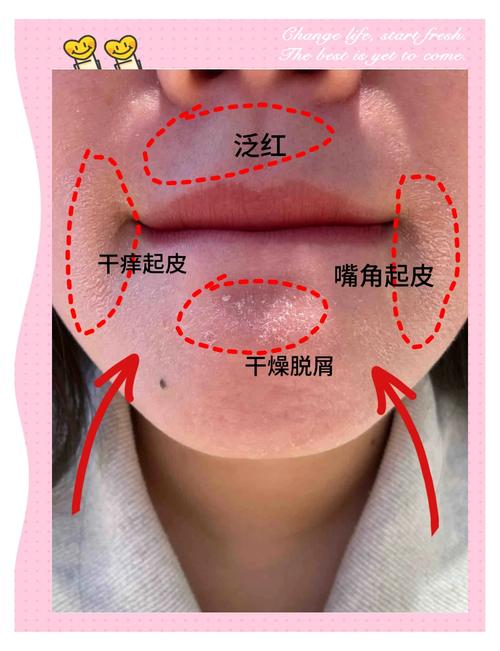 常见唇部错误护理动作示意图