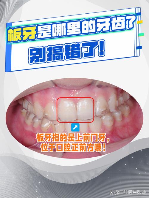 一块好板牙，硬在哪里
