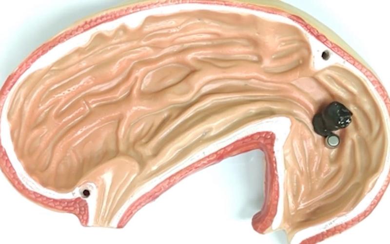 近期科研成果大赏：从粘液机器人到意念打字，科学比你想象的更离谱
