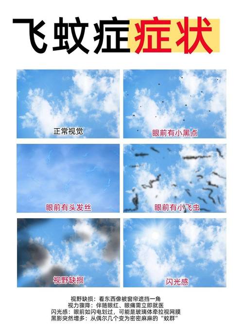 飞蚊症良性恶性黑影形态对比图