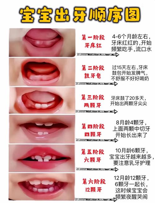 宝宝出牙不适常见误区科普对照表