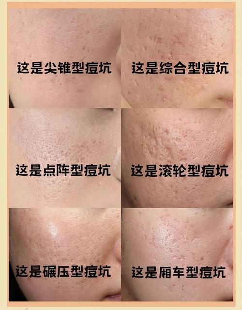 四、亲测的几个坑，还有补救办法