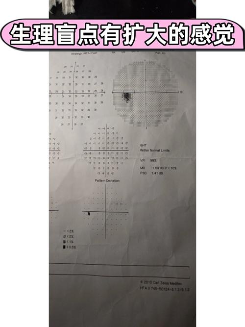 现在的盲点,和以前不一样
