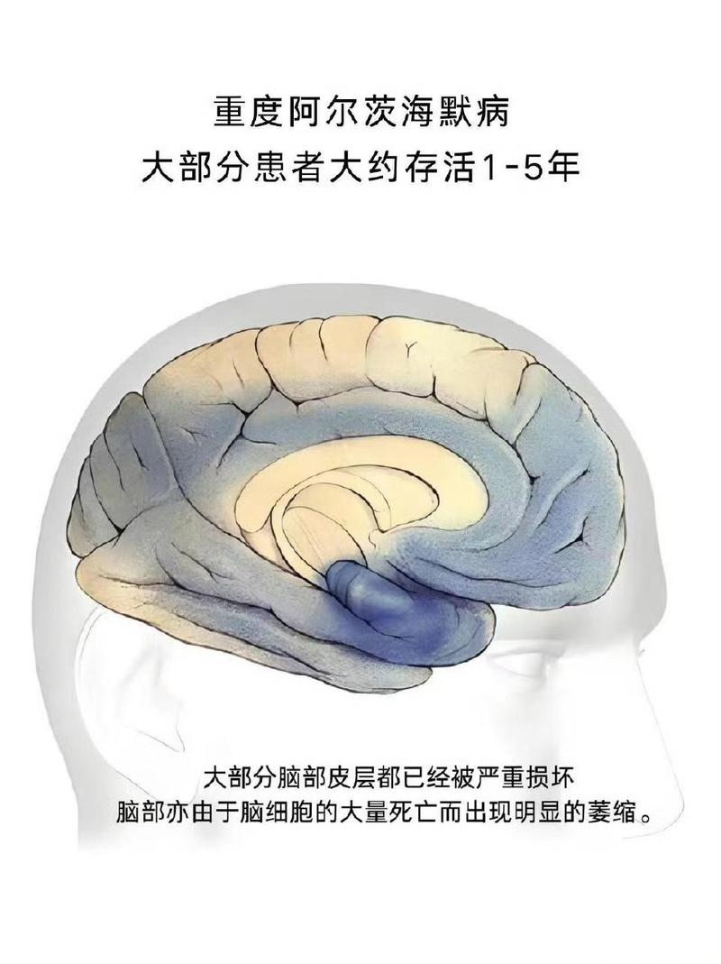 脑子里最该撕掉的误解
