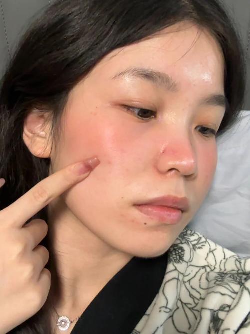 新娘焦虑护肤失败案例