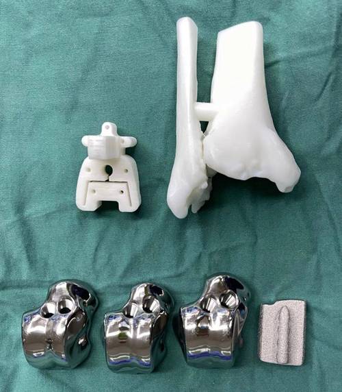 3D打印定制人体骨科假体实体图