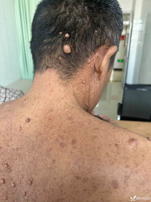 那层该死的积屑瘤