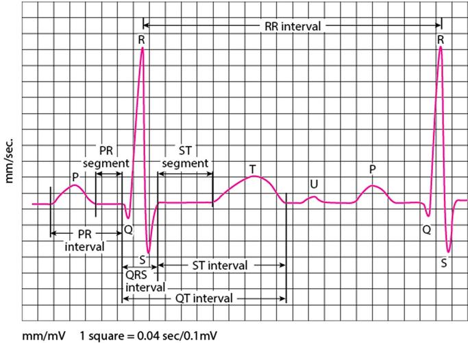心电图ECG：是玩具还是救心丸？