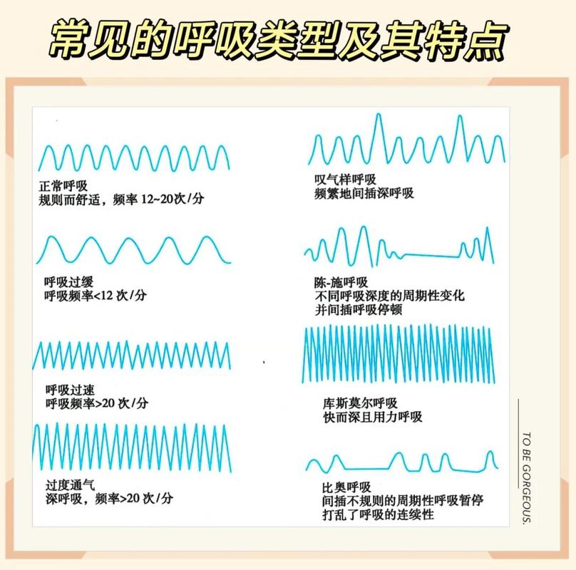 睡眠呼吸暂停呼吸停顿波形示意图