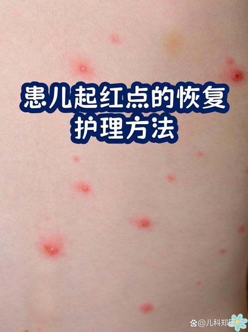 婴儿过敏皮疹居家观察对比图