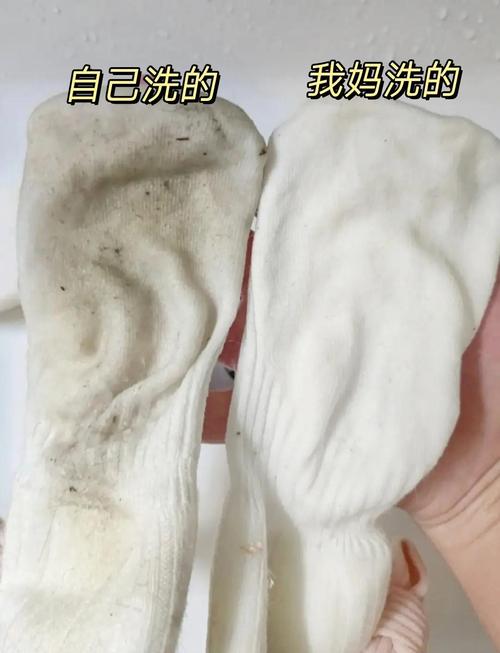 足癣患者袜子和普通衣物混洗的脏洗衣篮场景