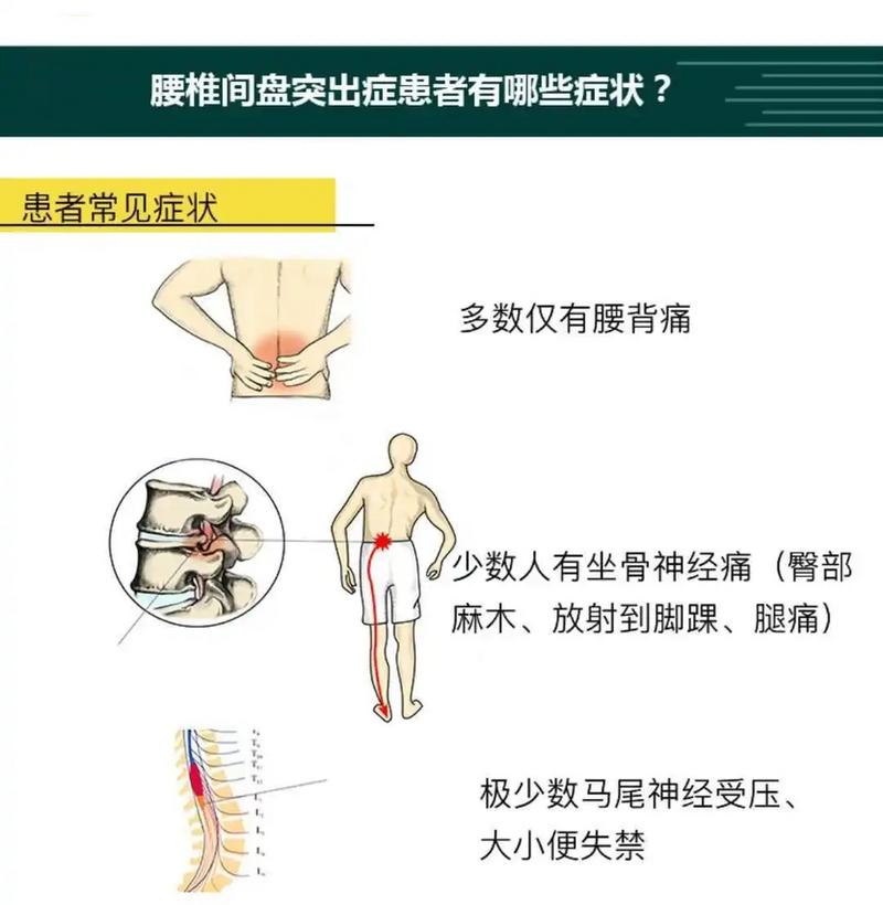 安装与人机工程:你的屏幕高度决定工人的腰椎