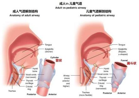 正常湿润呼吸道粘膜与干燥呼吸道粘膜对比图