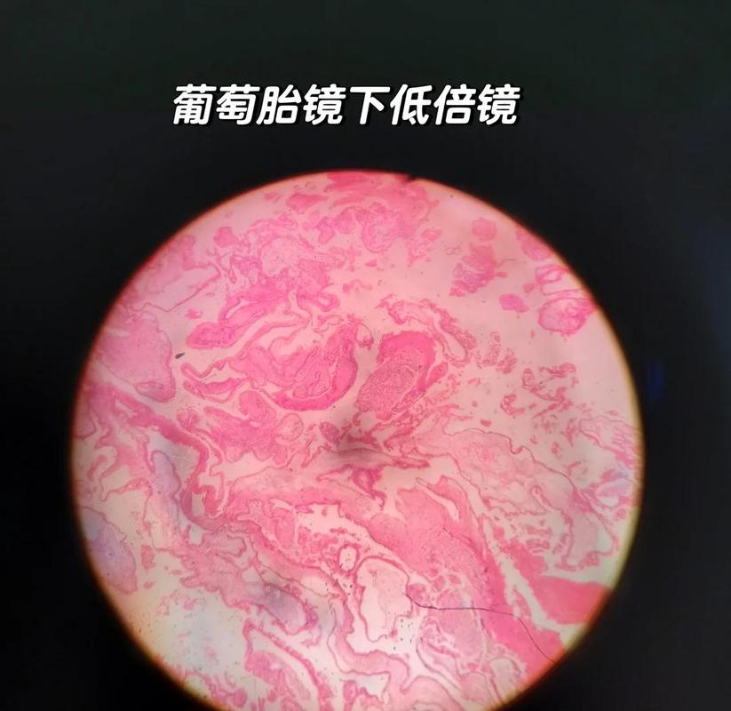 显微镜下葡萄籽横截面结构图