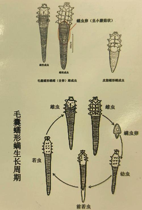 长毛地毯纤维显微下的螨虫分布图