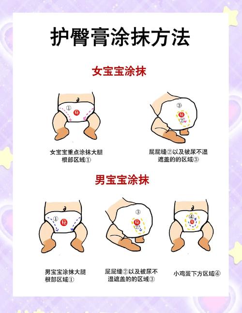 新生儿护臀膏正确涂抹示范图