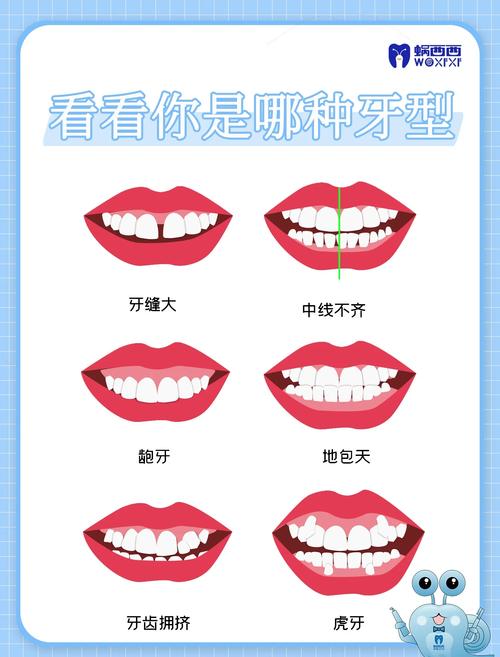 几种常见齿形适用场景对比示意图