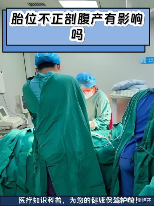 工业准妈妈容易踩的几个隐形坑