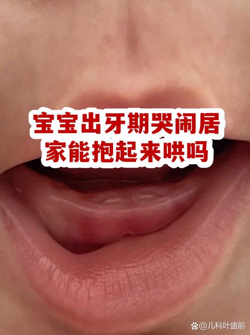 十个月宝宝出牙不适哭闹抱哄实拍图