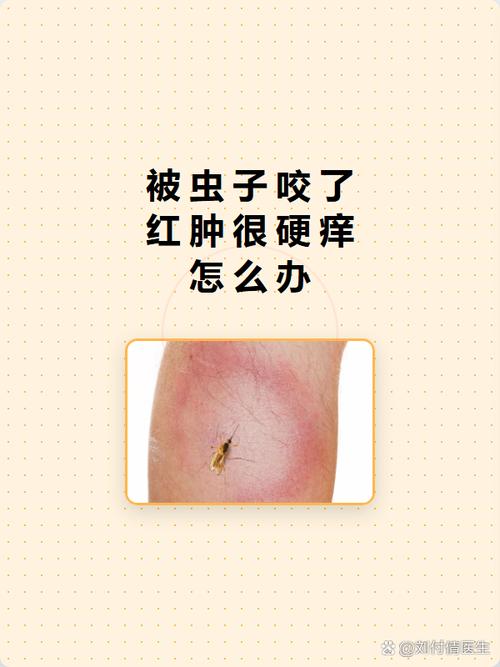 真遇上顽固虫子,别硬扛