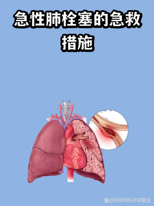 核心要点：就三条，但每一条都能救命