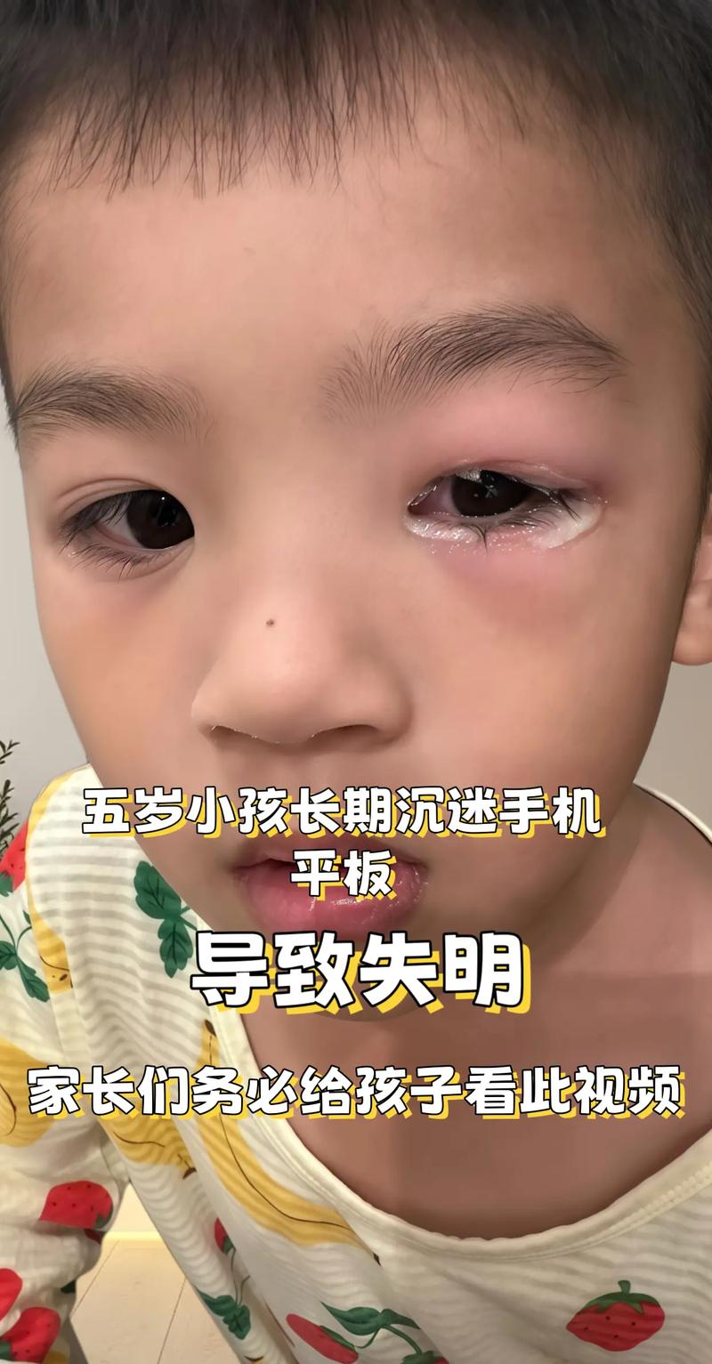 儿童长时间盯平板电脑眼神呆滞对比图
