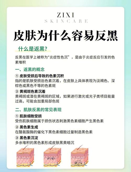 发黑后处理,九成的人都在这里踩坑