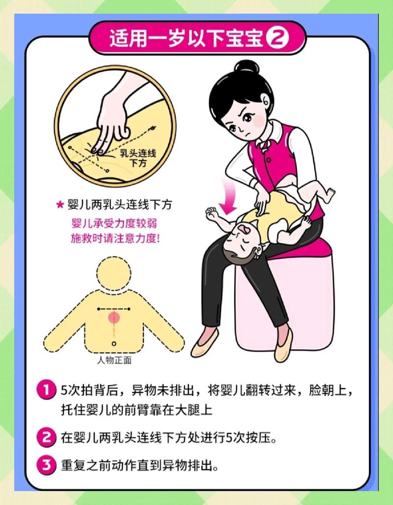 一岁以下婴儿气道异物急救操作示意图