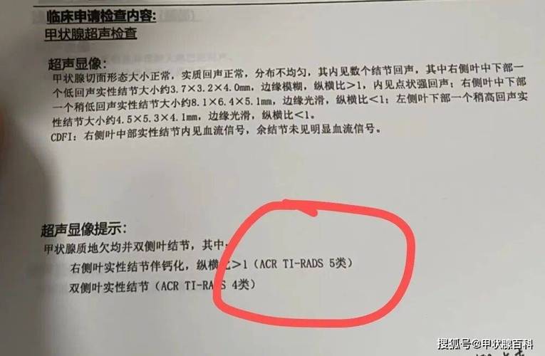 甲状腺结节体检报告异常标注页