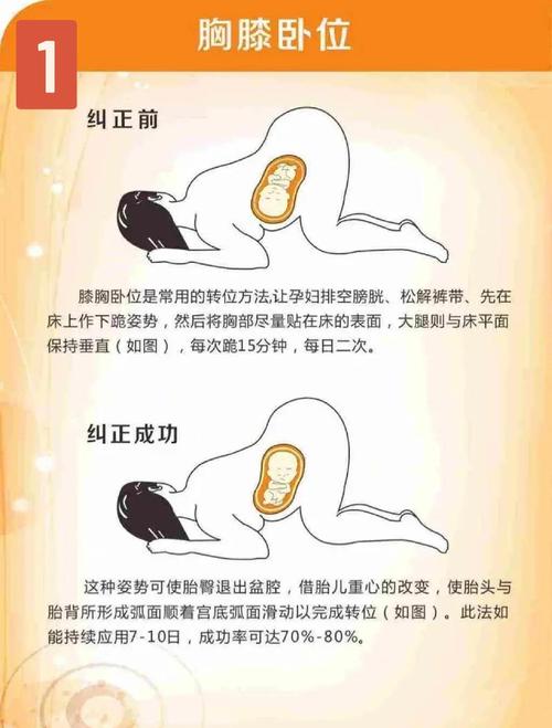 孕晚期站立姿势侧面示意图