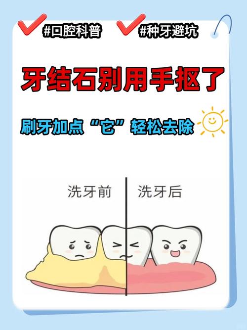 真要防住牙结石，根本不用你花大价钱