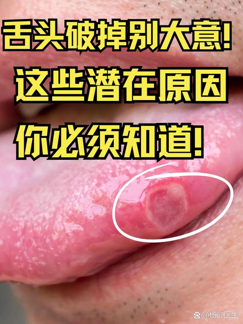 到底怎么破？