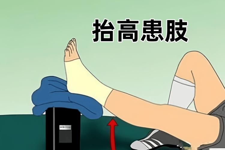 痛风发作下肢抬高垫枕头姿势图
