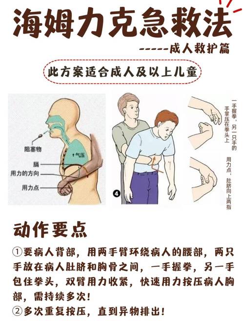 成人海姆立克急救法正确动作图