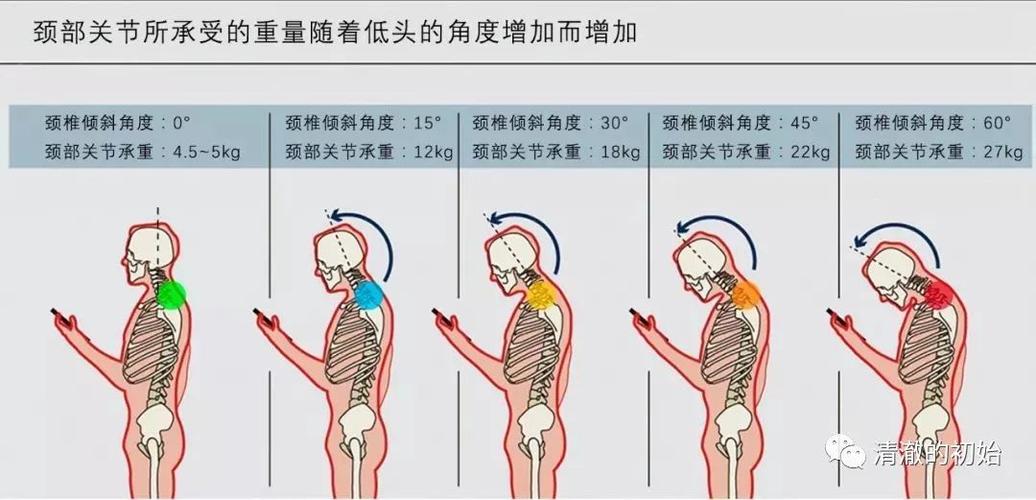 驾驶员驾驶时颈部肌肉受力对比示意图