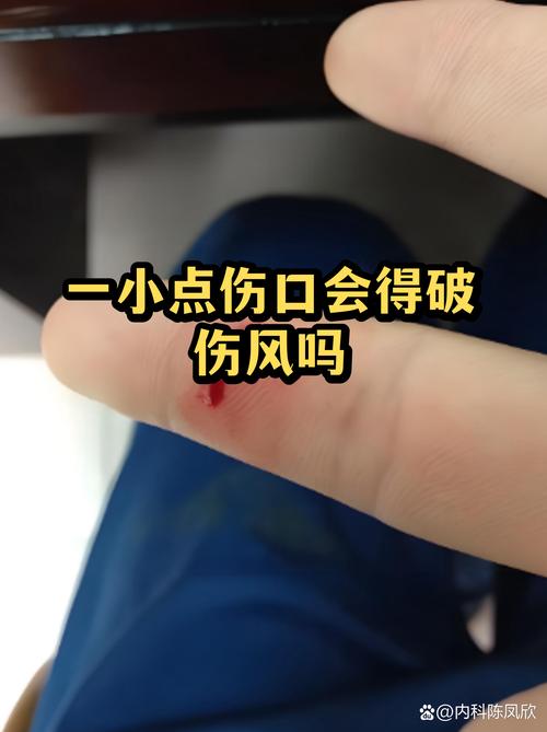 家庭客厅宝宝防烫伤隐患位置分布图