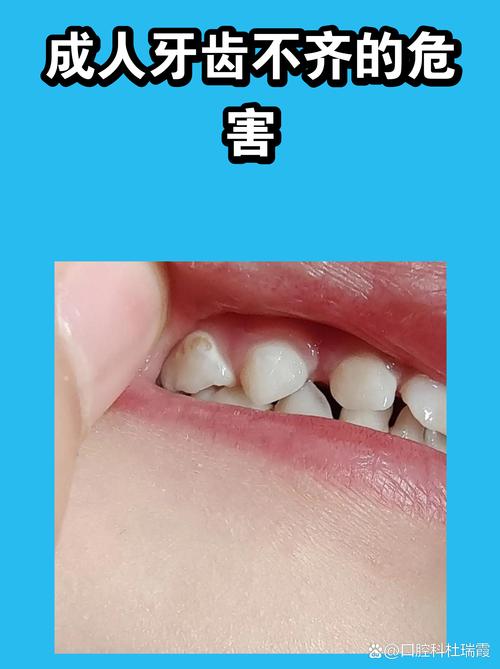 宝宝口腔清洁的就医红线,别硬扛