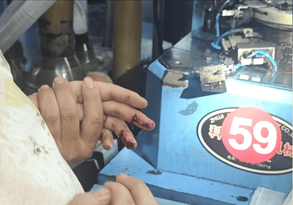 工业车间内工人操作机器未注意手部伤口