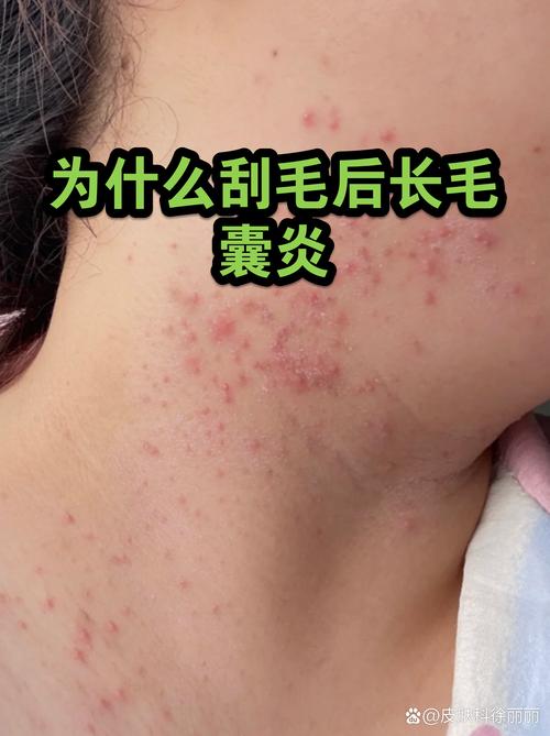 错误剃毛导致宠物毛囊受损发炎图
