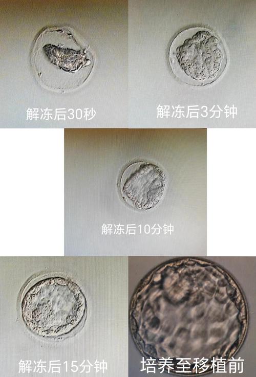 闹掰了，冷冻胚胎到底归谁