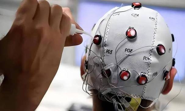 Neuralink的开颅人：进步还是恐怖片？