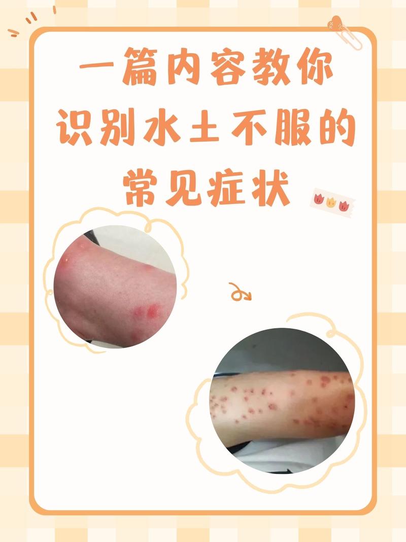 耐酸性,也有“水土不服”