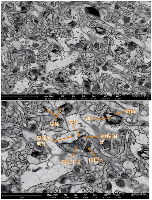类脑芯片神经元突触结构显微镜图