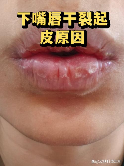 悄悄伤唇的几个隐形坏习惯