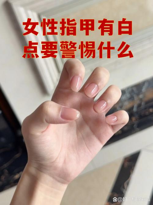 别信网上瞎传的，指甲那点事没那么玄乎