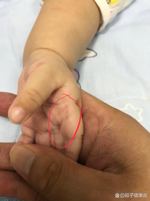 宝宝手眼协调发育的就医红线，记清楚