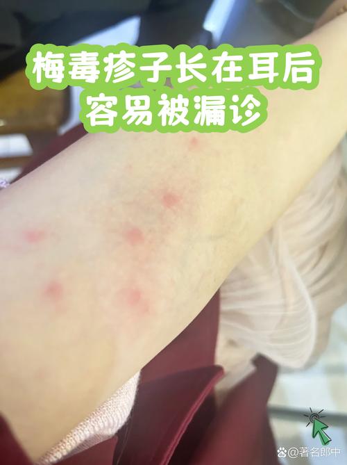 那些容易被漏掉的特殊情况