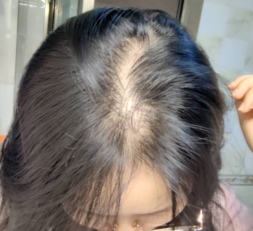 新手妈妈产后脱发梳后掉发量实拍